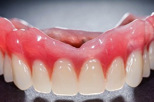 نسل جدید دندان مصنوعی، 100% غیر قابل تشخیص