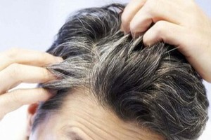 رفع سفیدی مو تضمینی فقط با یک دوره مضرف (مشاوره رایگان)