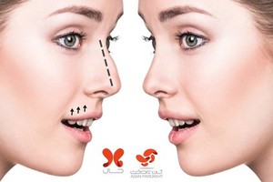 یکروزه عمل کن،  با "آپ" یکساله پرداخت کن!